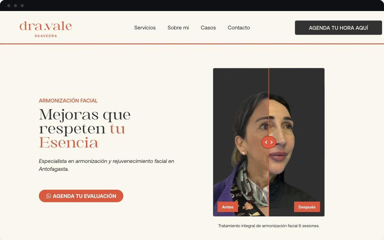 Sitio web de la Dra. Vale Saavedra, armonización facial en Antofagasta